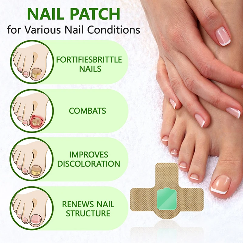 21Pcs Nail Fungus Patch Waterproof Nail Repair Patch Ingrown Correction Sticker Discolored Damaged Nail Gray Care Patches