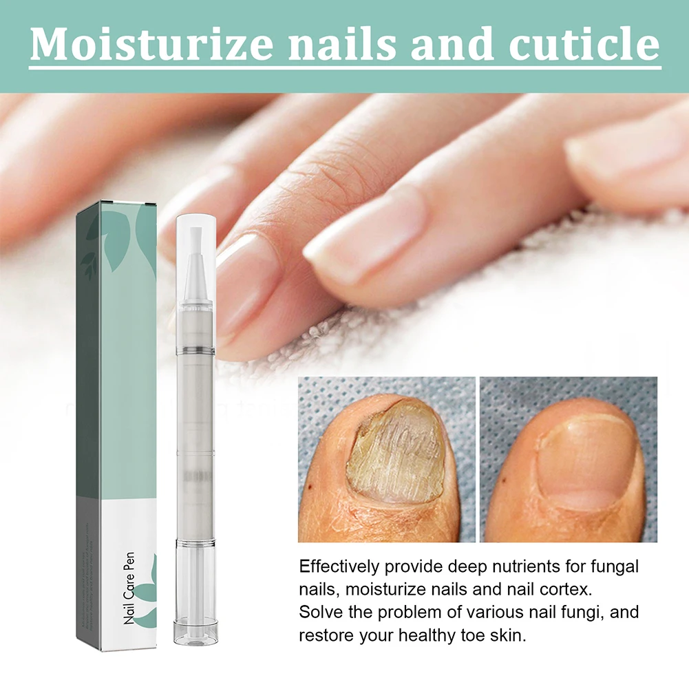 Nail Care Pen Exfoliating Onychomycosis Nail Care Solution Nail Moisturizing Repair Nailfinger Care Tools Finger Nail Treatment