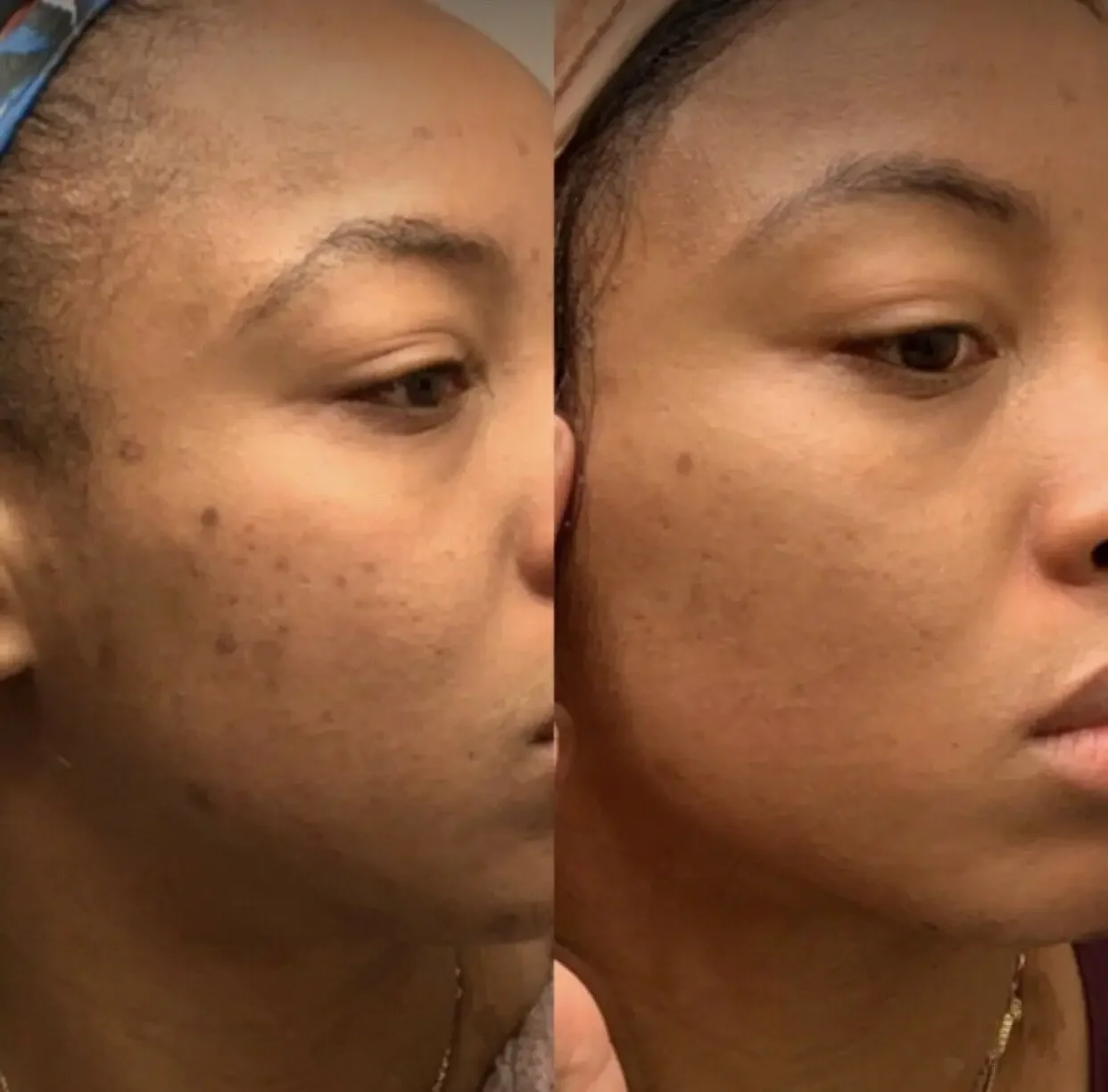 

Turmeric Soap Aloe Vera Bar, Dark Spots Remover, Discolorations, Uneven Skin Tone Glutathion Skin Whitening Organic Soap