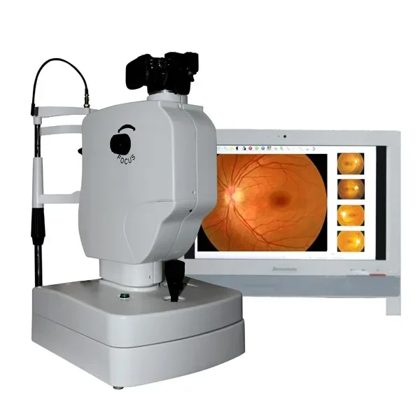 China best Medical Non-Mydriatic and mydriatic Retinal camera- LK-650A Fundus fluorescence