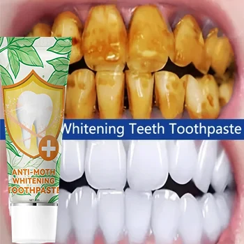 

Teeth whitening teeth cleaning Tooth decay repair Repair all tooth decay,Cigarette Stains Reduce Yellow cavities and protect