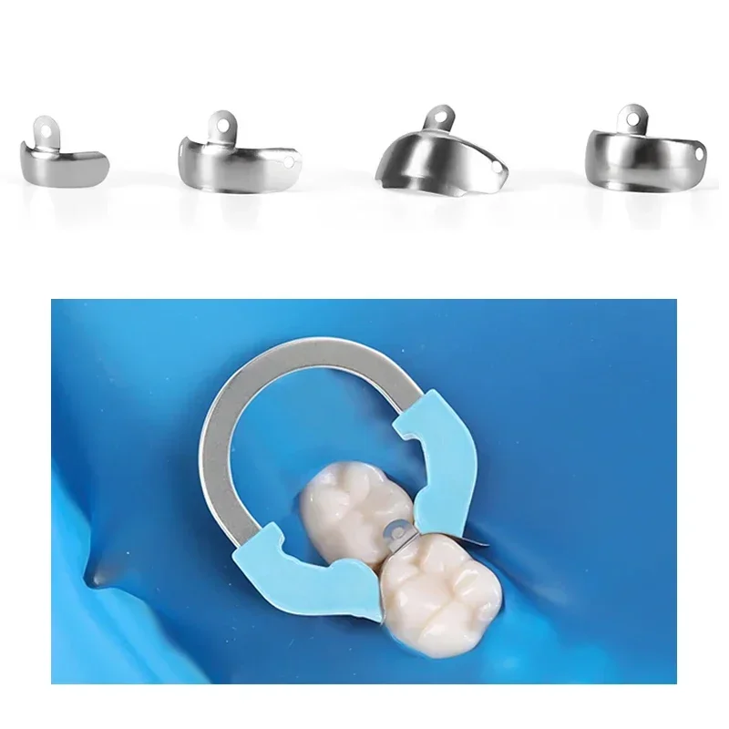 Dental Sectional Contoured Matrix System Nickel Titanium Clamping Ring Metal Matrix Bands Refill for Teeth Restorative Materials