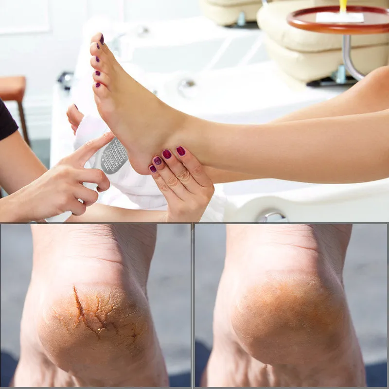 Ferramentas de pedicure de aço inoxidável arquivo de pé saltos raspas removedor de calos para pés raspador arquivo de aço inoxidável