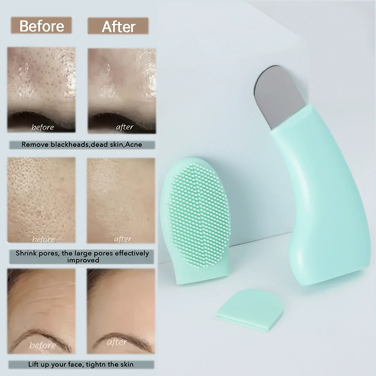2 STUKS Gezicht Ijs Roller Comedondrukker Set Siliconen Gezicht Lifting Ijsblokje Facial Massager Gezicht Schraper Schoonheid Huidverzorging gereedschap