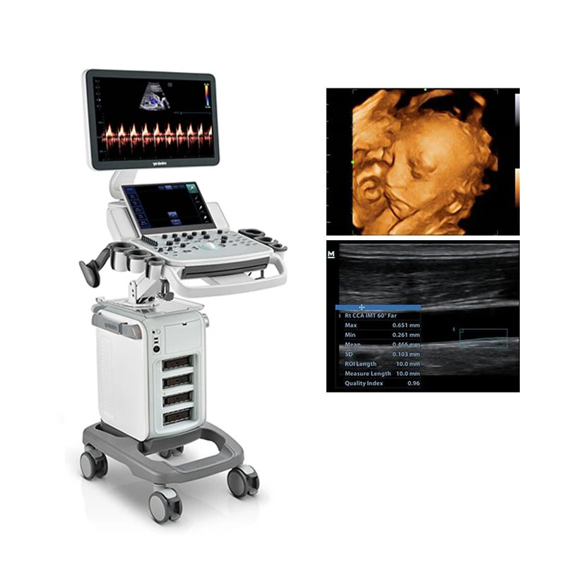 Best selling Mindray DC-40 trolley type medical ultrasound scanner usg machines 4D imaging ultrasonic instruments in good price