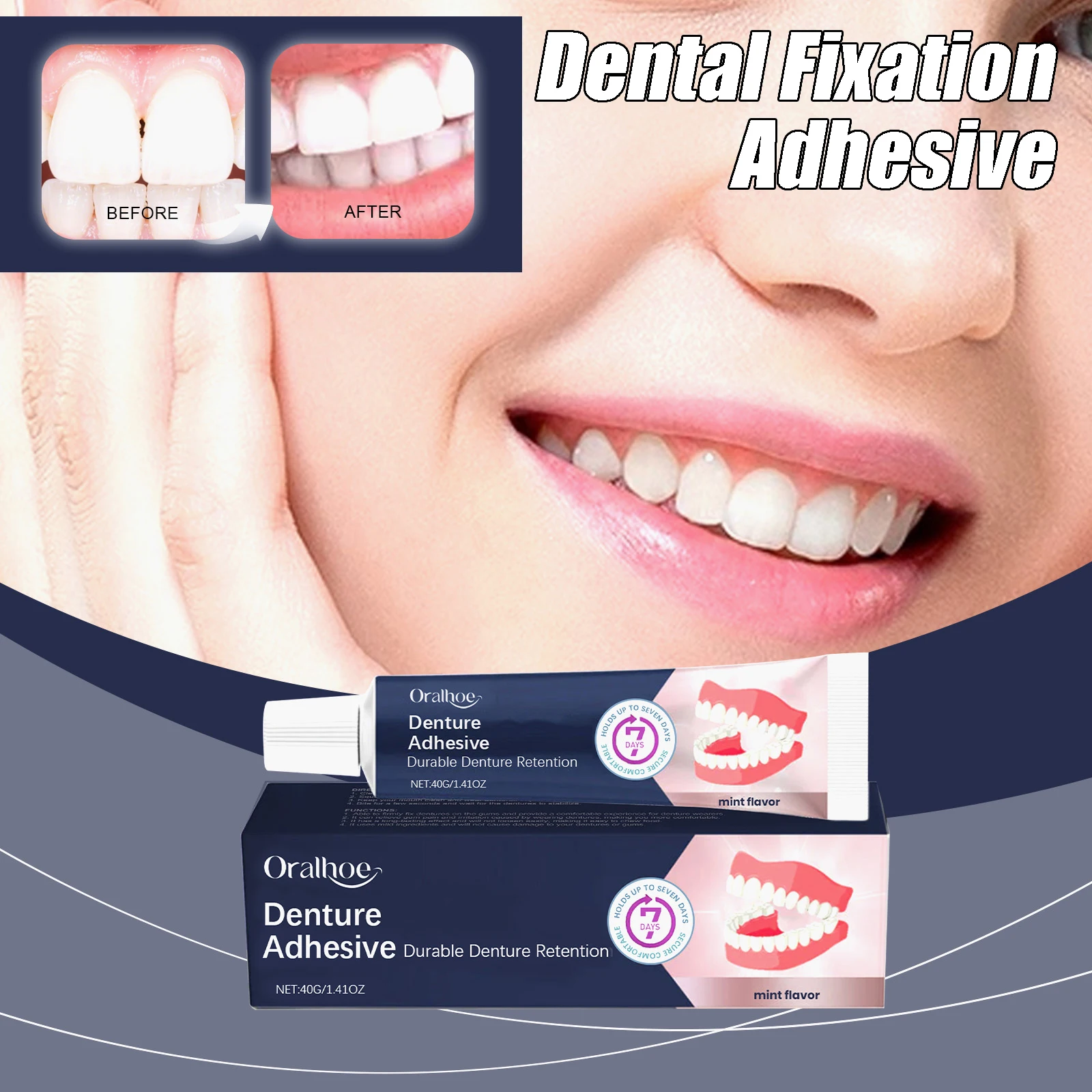 Dental Fixation Adh… - image