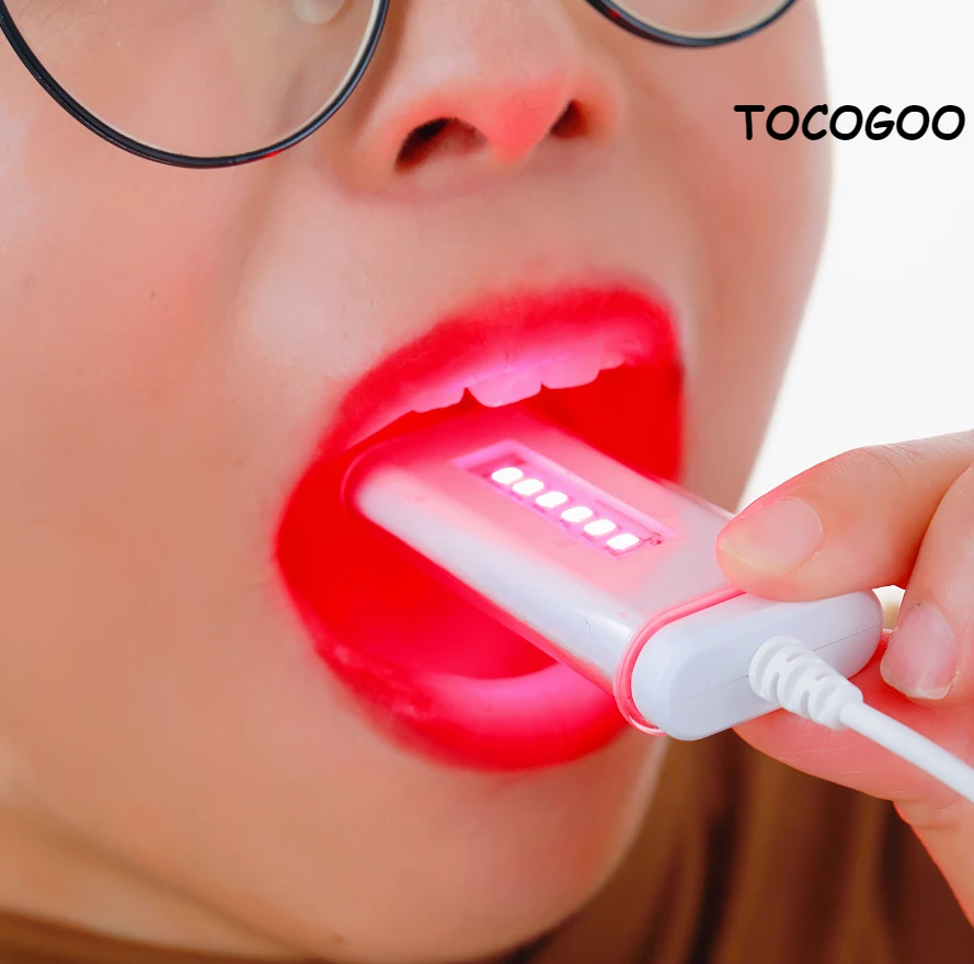 Laser Mouth Cleaning Mouth Ulcers Pharyngitis Bad Breath New Oral Therapy