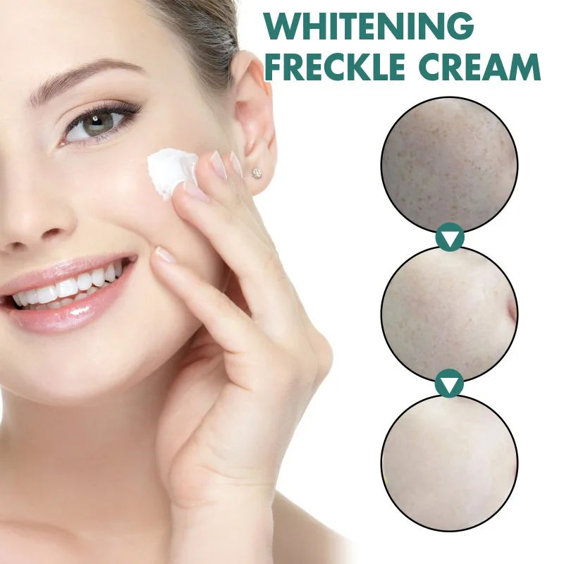 Whitening Freckles Cream Removal Melasma Melanin Anti-aging Brighten Face Dark Spots Remover Repair Moisturiz Care Products