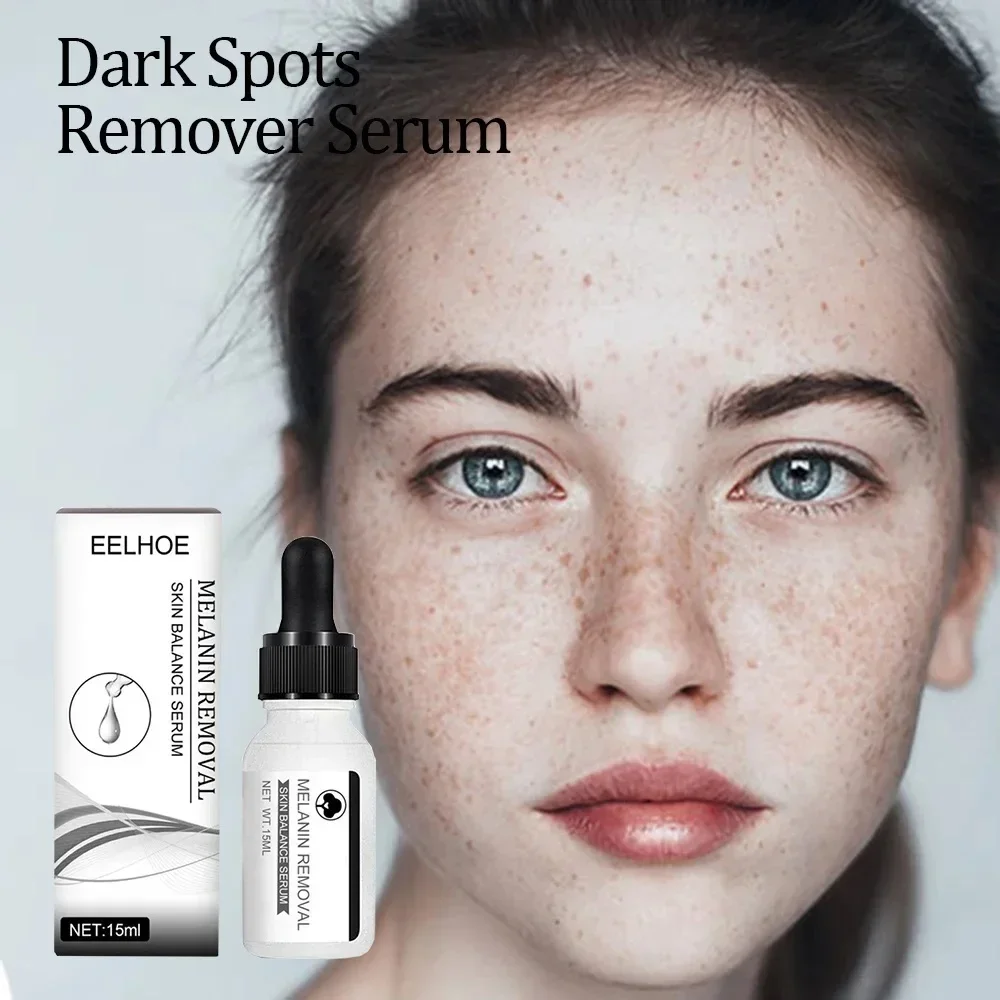 

Niacinamide Dark Spots Remover Serum Freckle Whitening Moisture Powerful Removal Black Dot Melasma Chloasma Face Skin Care Cream