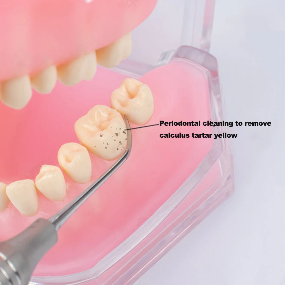 4-х шт. двухсторонний набор для удаления зубов из нержавеющей стали для чистки зубов и гигиенических процедур по экзамену