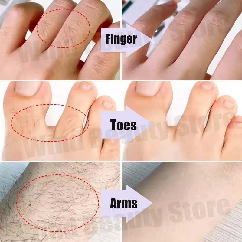 100g Hot Wax Hair Removal Depilatory Waxing Wax Beads for Wax Heater Painless for Body Hairs Removal Beans