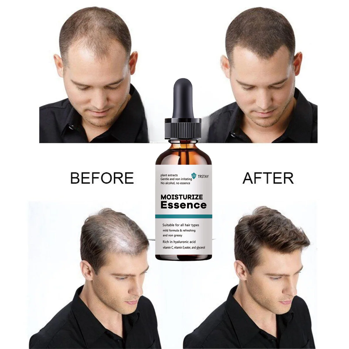 

2022 New Hair Growth Essence Promotes Hair Growth Tool Ginseng Oil Grower Anti Hair Loss Professional Brazilian Keratin