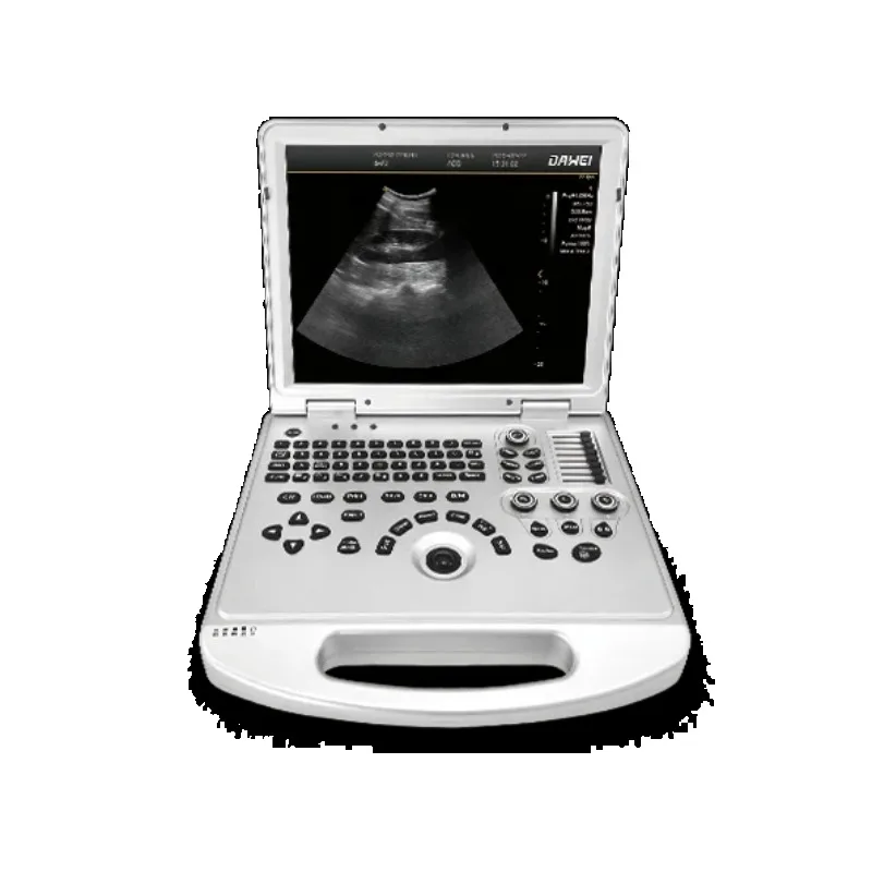 Dawei DW-L3 Color Ultrasonic Diagnostic Apparatus portable ultrasound machine for OB/GYN