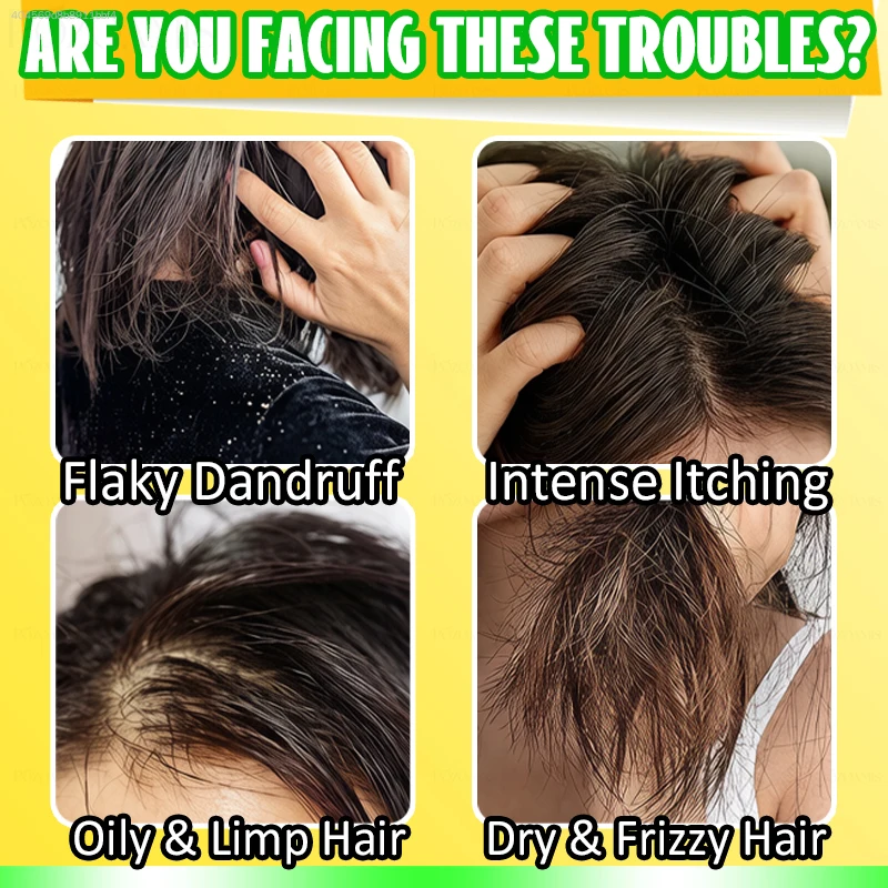 แชมพูบาร์สูตรพฤกษศาสตร์สำหรับผ - Hair Care Dandruff บทวิจารณ์และราคา
