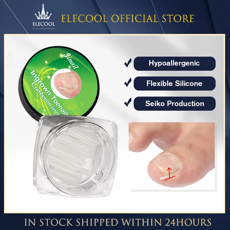Schmerz linderung Nagel rillen polster korrigiert ein gewachsene Nägel Fußpflege werkzeuge langlebige, einfach zu verwendende ein gewachsene Pads effektive Fußpflege