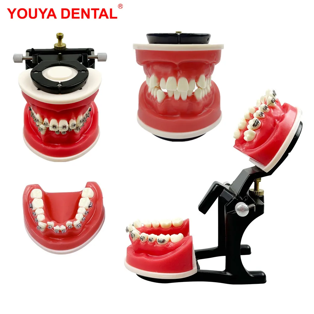 Dental Orthodontic Model Typodont Teeth Model For Dental Technician Practice Training Teaching   Ortho Bracket Treatment Models
