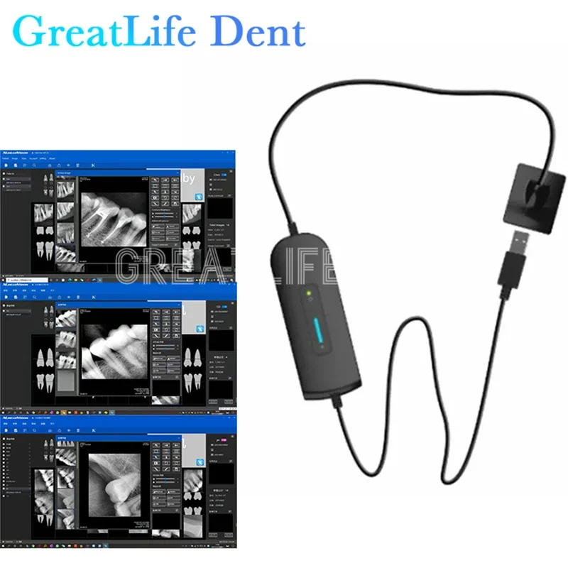 Meksiko RU EU ES SA IT Tersedia Sensor Gigi Sensor Sinar X Gigi Kamera Intra Oral Sistem Intraoral Gigi Gambar Sensor HDR