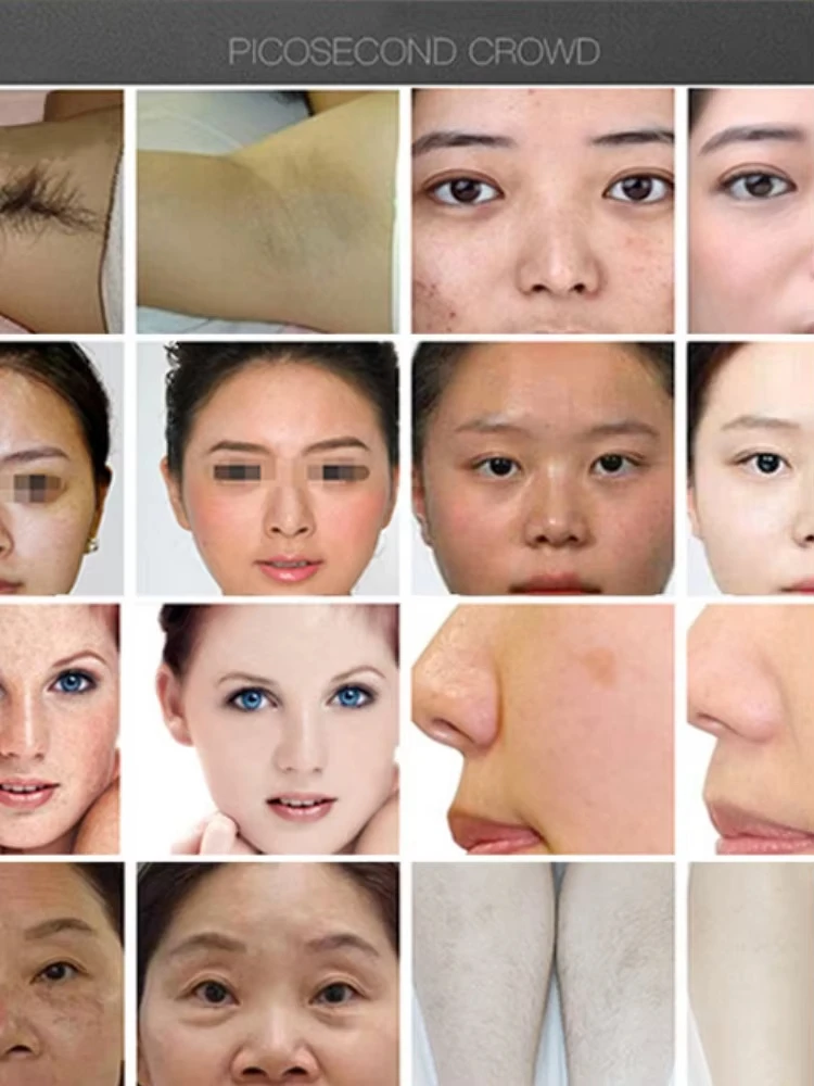 2025 صالون جديد آلة إزالة الشعر بالليزر IPL محمولة للغاية معدات احترافية ليزر ديود -/