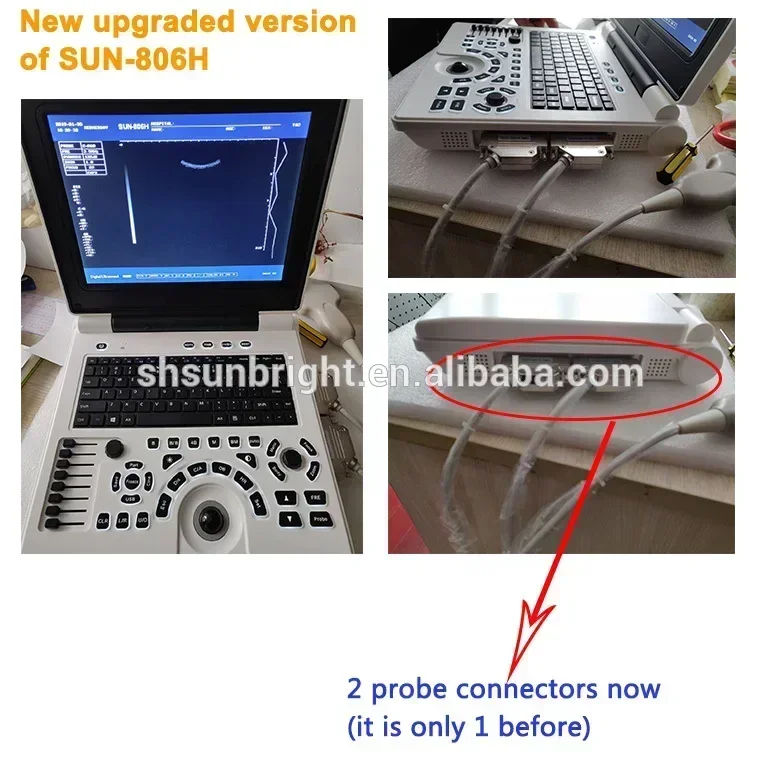 Cheap Ecograph Laptop Black and White Ultrasound cheaper than logiq ultrasound 2D machine