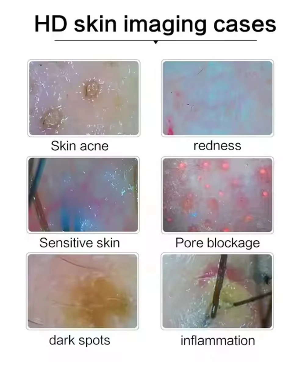 10 Polegada lcd detector de couro cabeludo digital analisador de pele do cabelo microscópio para testes de folículo capilar e análise de pele lupa 50/200x