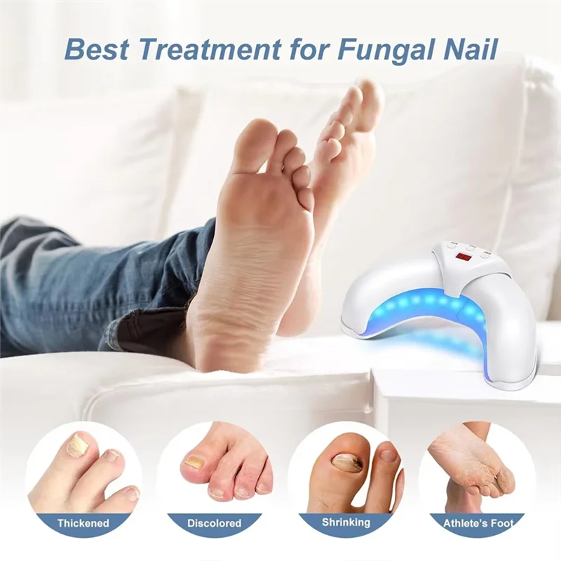 ABUU-Nail Schimmel Laser Behandeling Apparaat Vingernagel Schimmel Behandelen Onychomycose Effectief Verwijderen Onychomycose Groeien Teennagel