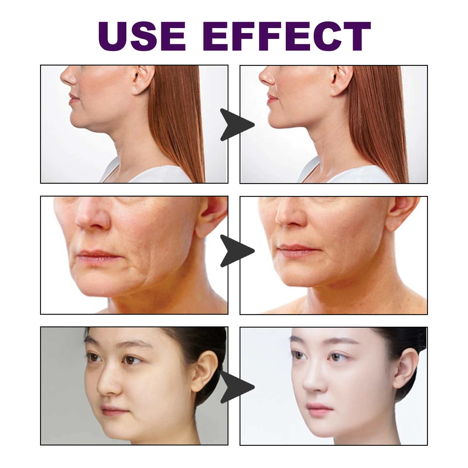 EELHOE 60pcs Facial Lifting Patches Invisible Jawline Shaping V Face Lift Tape Smoothing Fine Lines Skin Care Daily Use