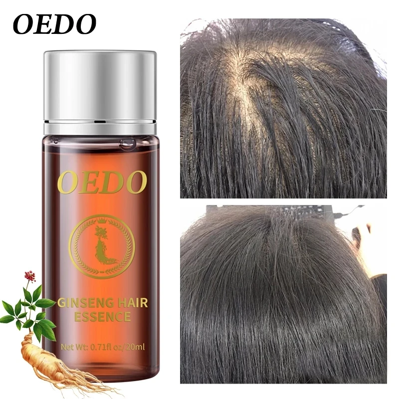 20ML Ginseng Hair Growth Essence Preventing Hair Loss Liquid Damage Hair Repair Treatment Dense Fast Restoration Hair Growth - view 3