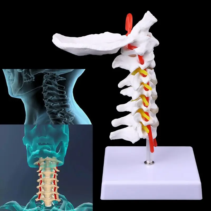 Vertebra Serviks Arteria Tulang Belakang Saraf Tulang Belakang Model Anatomi Ukuran Hidup