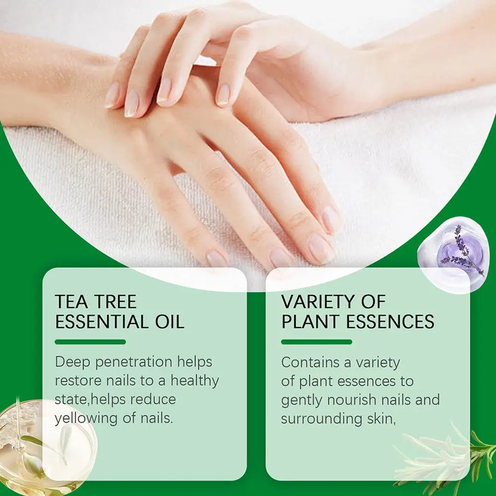 Teennagel Schimmel Behandeling Tea Tree Etherische Olie Voor Beschadigde En Verkleurde Teen Nagels Vingernagel Schimmel Onychomycosis Care Sol G0d3