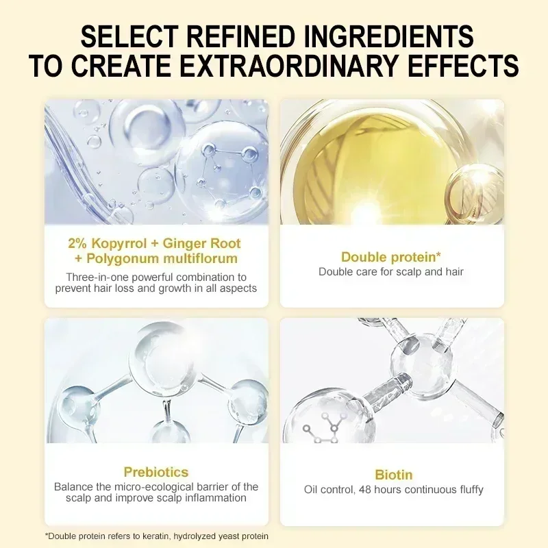 효과적인 빠른 모발 성장 생강 오일 관리, 산후 탈모 방지, 두피 트리트먼트 세럼, 남성 및 여성용 세럼