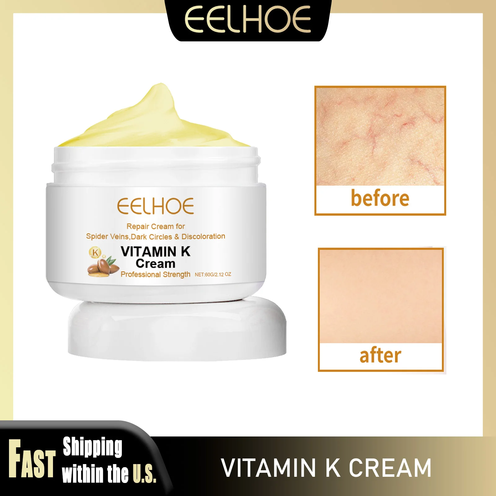 

EELHOE 60g Vitamin K Cream Improve Varicose Veins Relieve Leg Soreness Effective Eliminate Swelling Ascorbic Acid Ointment