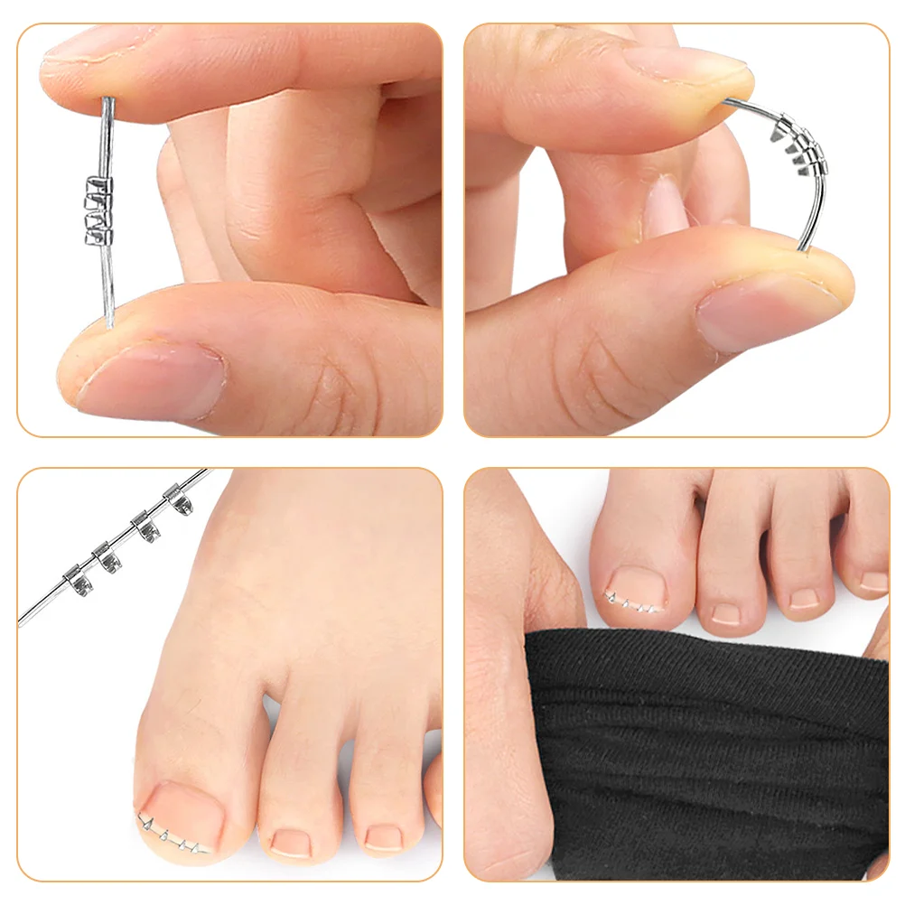 4 Pcs Toe Fixation Tape Tool Toenails Correction Buckles Ingrown Brace Straightening Clip for Carbon Steel Men and Women