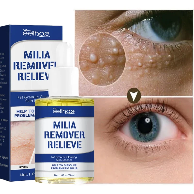 Fat Granules Removal Eye Serum Anti Dark Circle Eye Bags Fade Fine Line Essence Anti-Puffiness Moisturizing Skin Care Products