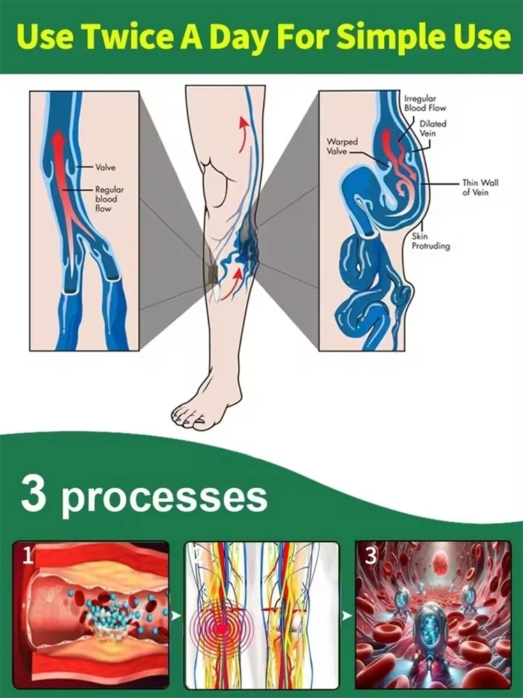 Wᴇᴀʀ Sʜᴏʀᴛs Wɪᴛʜ Cᴏɴғɪᴅᴇɴᴄᴇ: Vᴀʀɪᴄᴏsᴇ Cʀᴇᴀᴍ Tʜᴀᴛ Sᴜᴘᴘᴏʀᴛs Yᴏᴜʀ Vᴇɪɴs