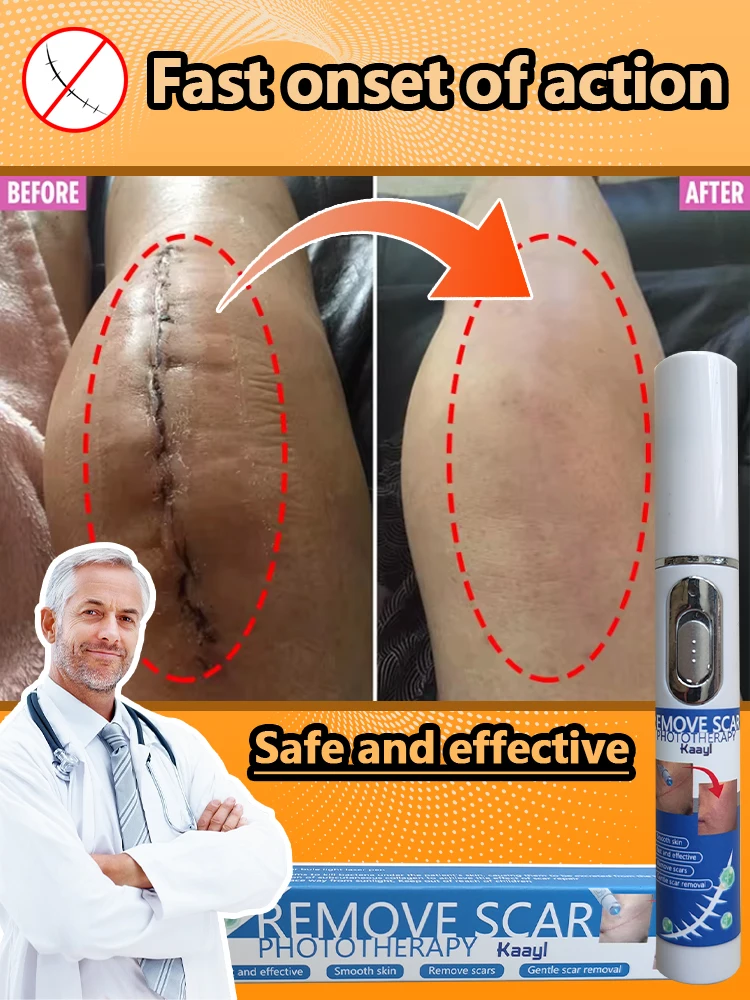 

Fast Remove Burn Keloid | Effective for Old & New Scars on Face & Body | Safe and Efficient