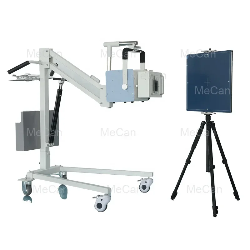 Digital Mobile Xray Machine Medical Diagnostic X-ray Equipment High Frequency 5KW 100MA Portable X-ray