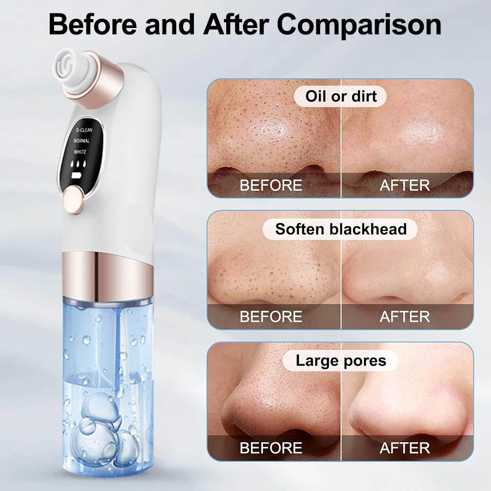 Blackhead Remover Electric Black Head Remover Pore Vacuum Cleaner Micro Small Bubble Rechargeable Water Cycle Black Dot Remove