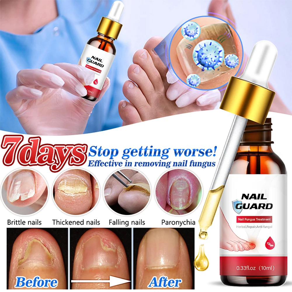 Nail Fungus Treatment Device Repair Toenail Fingernail Treat Toenail Nail Fungal Treatment Essential Oil Onychomycosis