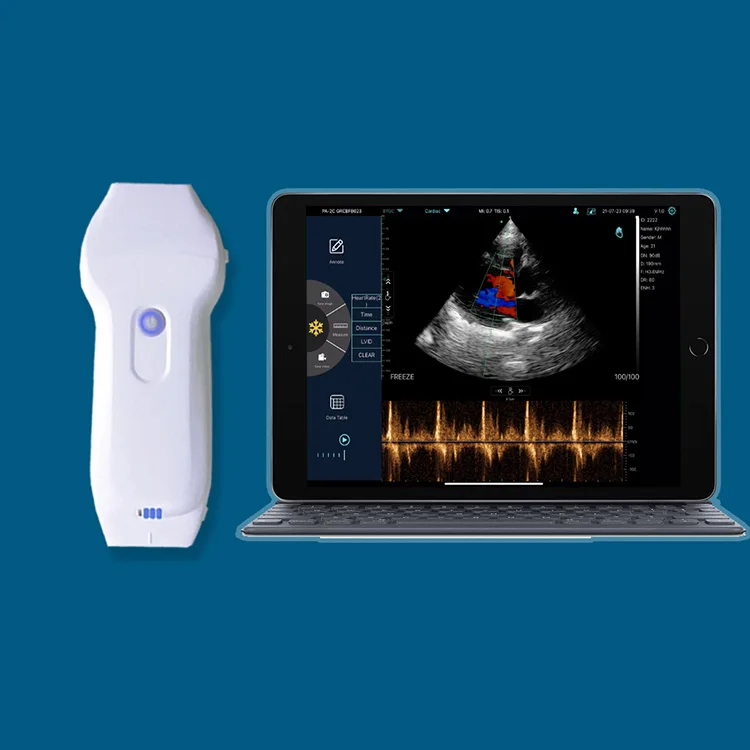 Cardiac Ultrasound Konted C10XL Double Head 3 in 1 Color Doppler Wireless Ultrasound Phased Array+Linear Probe