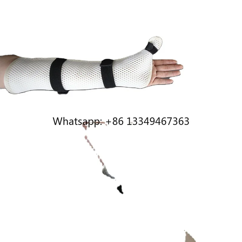External Fixation Elbow Type Thermoplastic Fracture Splint for Nerve and Soft Tissue