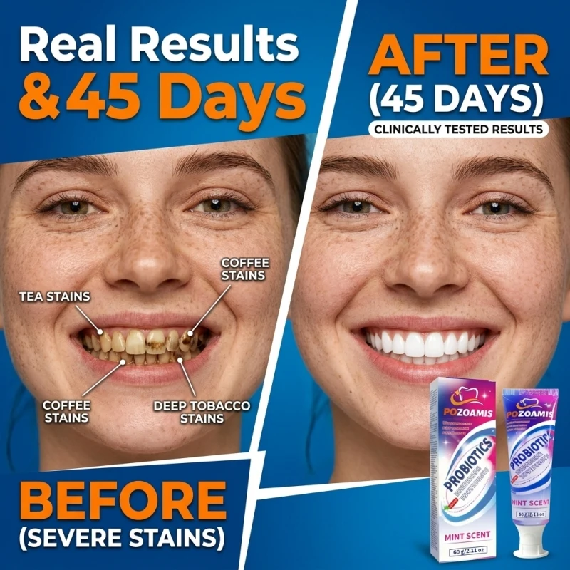 Daily Liquid Whitening Toothpaste for Brushing, Helps Clear External Surface Stains including Tea, Coffee and Smoke Deposits, Improve Teeth Visual Brightness