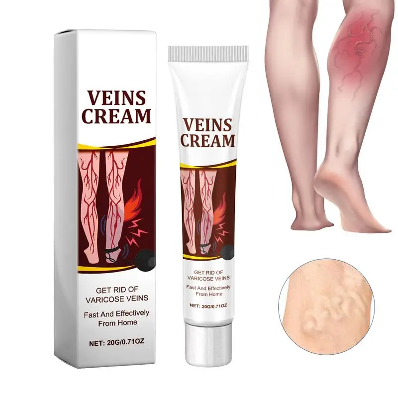 Varicose Cream Veins care cream Relieve Swelling caused by bulging veins in the legs Veins massage care cream