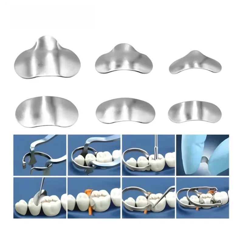 No 1.398 No 1.330 Dental New Douban Forming Sheet Metal Automatic Forming Sheet Dental Restoration Auxiliary Material Oral