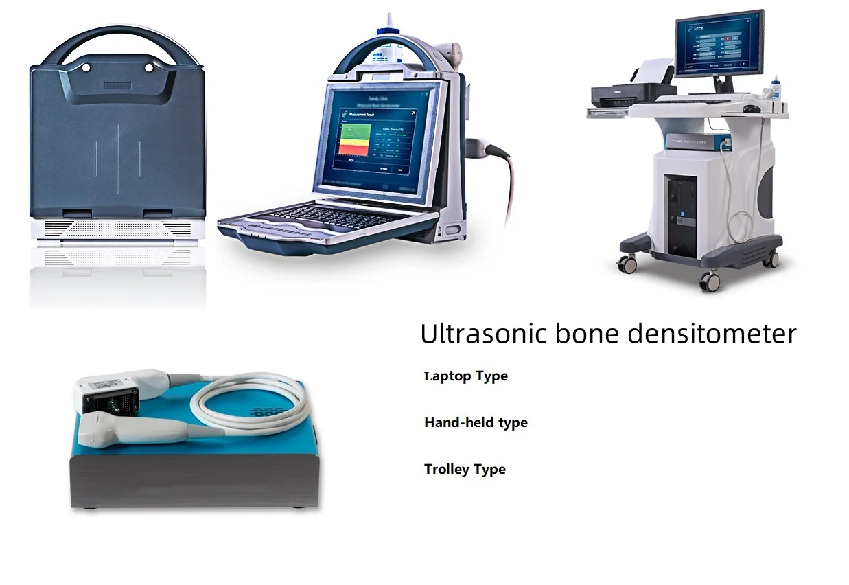 Whole Body Assessment Bone Densitometer with table Medical Rapid Scanning Dual-Energy X-ray Absorptiometry Bone Densitometry