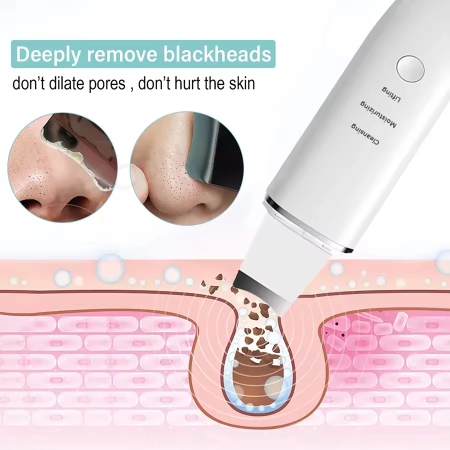 Spatola per il viso a vibrazione elettrica Scrubber per la pelle ad ultrasuoni per il viso Dispositivo per la rimozione dei punti neri per una pulizia profonda