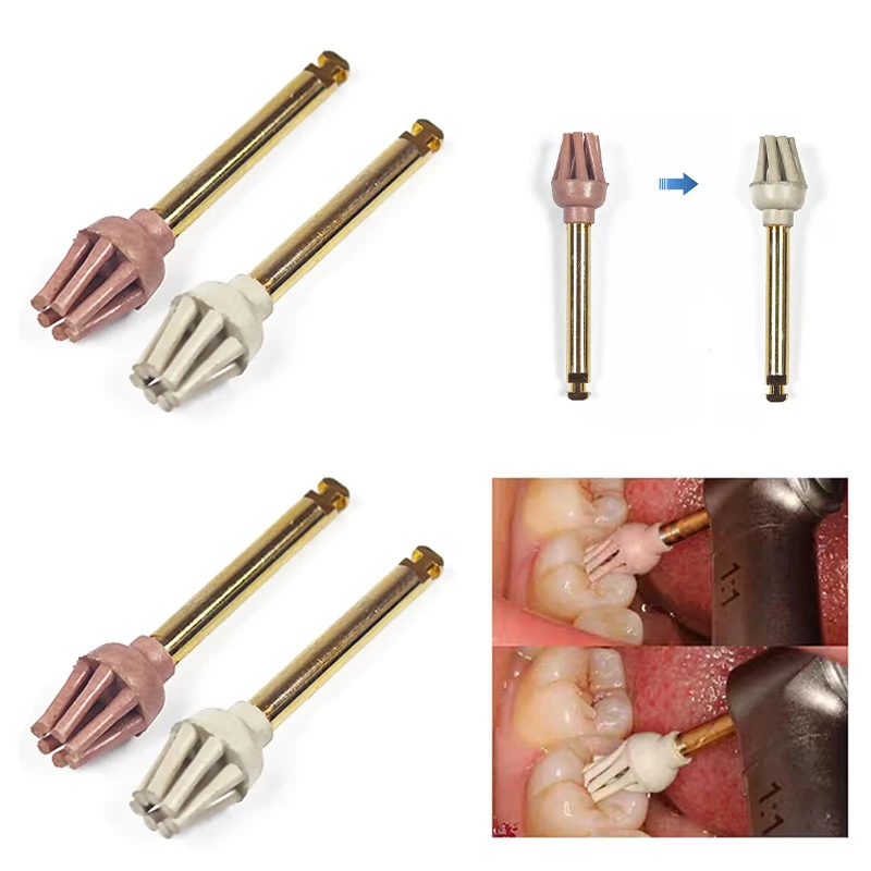 8-teiliges Dental-Gummi-Polierset, 2-Stufen-Diamantpolierer, RA-Keramik-Restaurations-Schleifset, Spiral-Flex-Radbürste für Zahnmedizin – Detail 4