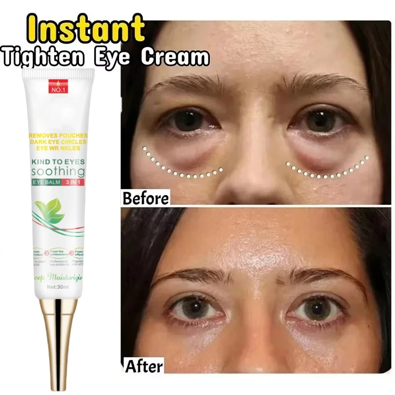 Creme removedor de grânulos de gordura para os olhos, creme anti-inchaço para rugas, clareia olheiras, desbotamento de linhas finas, hidratante, cuidados com os olhos