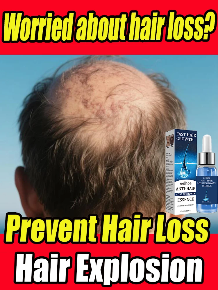 

Natural Essence for Anti-Hair Loss Stimulates Hair Growth Prevents Excessive Shedding Enhances Hair Elasticity Healthier Hair