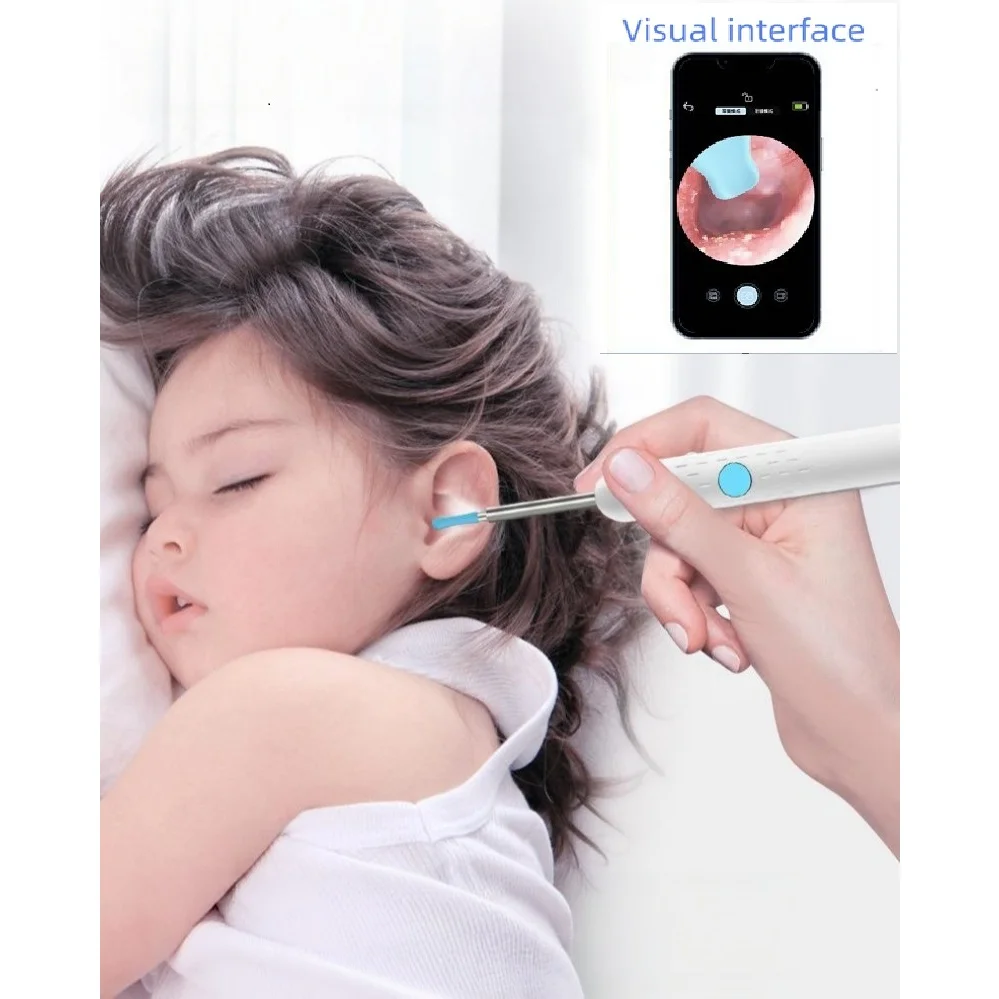 1080P Hd Otoscope Endoscope Ear Cleaning Camera for Iphone/Android Earwax Removal Kit; 4.2mm Visual Ear Spoon