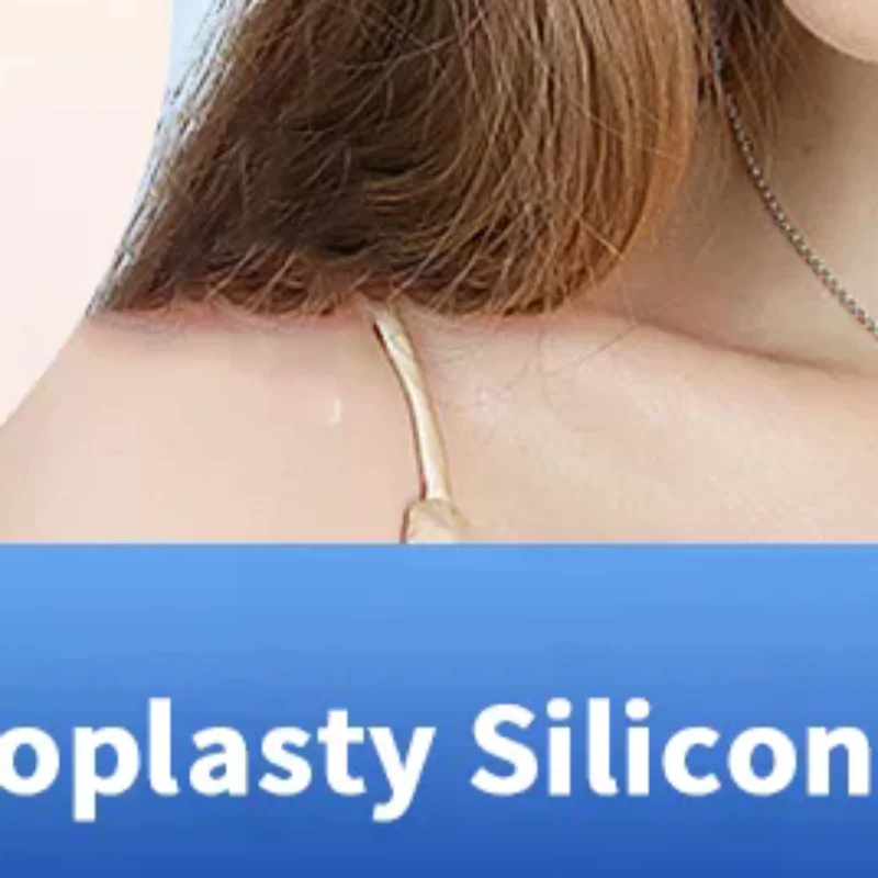 

Прозрачный зеленый силиконовый назальный сплинт для септопластики, медицинские расходные материалы, внутренний назальный воздуховодный сплинт с стерилизацией